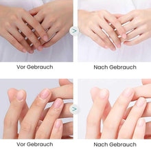 Lade das Bild in den Galerie-Viewer, CareClip - Sichere, schmerzfreie Nagelpflege – mit nur einem Klick