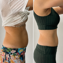 Lade das Bild in den Galerie-Viewer, Formkur - Anti-Cellulite Massagegerät für Bauch, Beine & Po