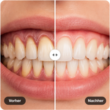Lade das Bild in den Galerie-Viewer, Zahnfleischvital Pro - Zahnfleisch wieder aufbauen in nur 10 Minuten pro Tag
