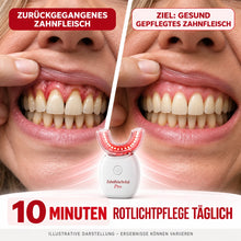 Lade das Bild in den Galerie-Viewer, Zahnfleischvital Pro - Zahnfleisch wieder aufbauen in nur 10 Minuten pro Tag
