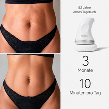 Lade das Bild in den Galerie-Viewer, Formkur - Anti-Cellulite Massagegerät für Bauch, Beine &amp; Po