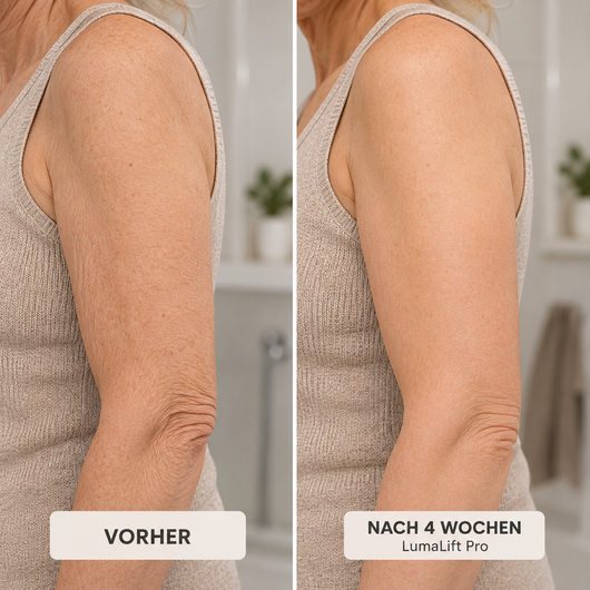 LumaLift Pro - Gerät zur Formung und Straffung von Armen & Körper